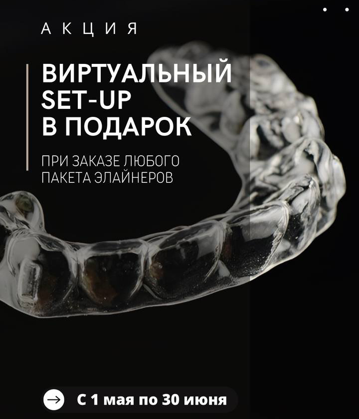 Виртуальный Set Up в подарок